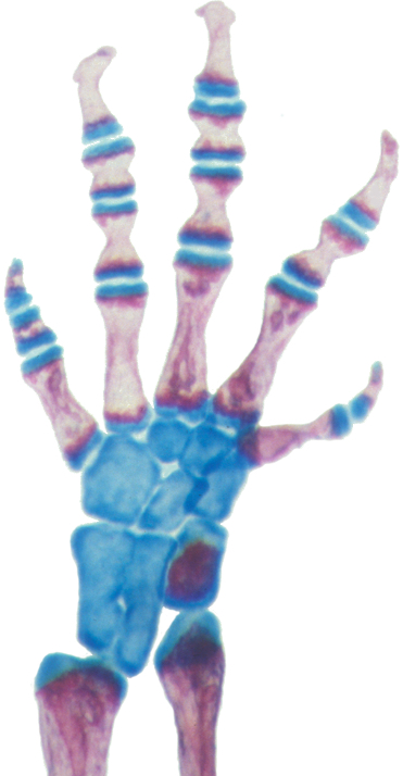 Digital x-ray of Thorius longicaudus.